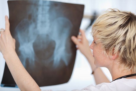 Перелом копчика: симптомы и лечение Перелом копчика: симптомы и лечение