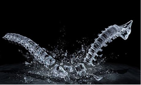 Перелом копчика: симптомы и лечение Перелом копчика: симптомы и лечение