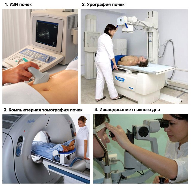 Почечное давление: причины, симптомы и лечение, как лечить артериальную гипертензию Почечное давление: причины, симптомы и лечение, как лечить артериальную гипертензию