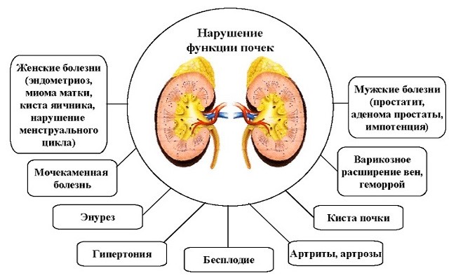 Заболевание почек симптомы болезни и лечение Заболевание почек симптомы болезни и лечение