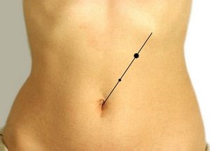 Какими должны быть размеры поджелудочной железы в норме? Какими должны быть размеры поджелудочной железы в норме?