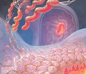 Что делать, если болит желудок после приема антибиотиков? Что делать, если болит желудок после приема антибиотиков?