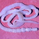 Лейкоциты и белок в моче Лейкоциты и белок в моче