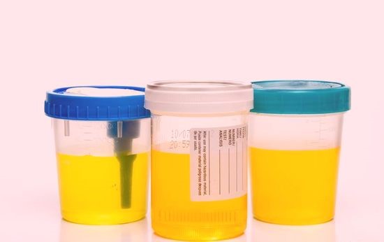 Лейкоциты и белок в моче Лейкоциты и белок в моче