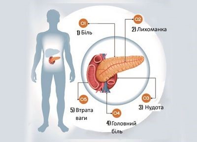 Характерные симптомы заболеваний желчного пузыря и поджелудочной железы Характерные симптомы заболеваний желчного пузыря и поджелудочной железы
