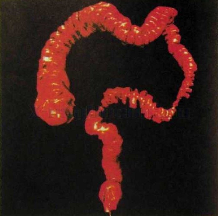 Неинвазивный метод исследования - рентген брюшной полости Неинвазивный метод исследования - рентген брюшной полости