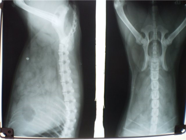 Снимок пояснично крестцового отдела позвоночника Снимок пояснично крестцового отдела позвоночника