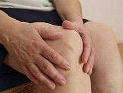 Ревматоидный артрит Ревматоидный артрит