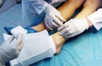 Склеротерапия вен нижних конечностей Склеротерапия вен нижних конечностей