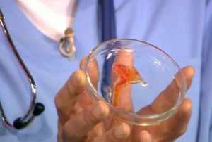 Причины появления соплей с кровью при гайморите Причины появления соплей с кровью при гайморите