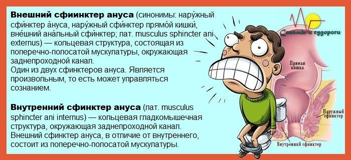 Спазмы сфинктера – развитие, причины и симптомы Спазмы сфинктера – развитие, причины и симптомы