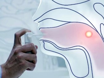 Спрей от ангины с антибиотиком: особенности назначения Спрей от ангины с антибиотиком: особенности назначения