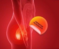 Инструкция по применению спрея от геморроя Гемодерм с ценами и отзывами Инструкция по применению спрея от геморроя Гемодерм с ценами и отзывами