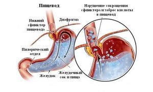 Причины появления горечи и сухости во рту Причины появления горечи и сухости во рту