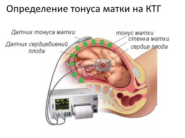 Норма сердцебиения плода по неделям Норма сердцебиения плода по неделям