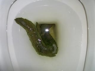 Симптомом чего может быть желтый кал? Симптомом чего может быть желтый кал?