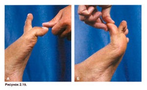 Лечение травмы плюснефалангового сустава Лечение травмы плюснефалангового сустава