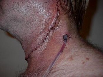 Как убрать сопли из носоглотки ребенка до года? Как убрать сопли из носоглотки ребенка до года?