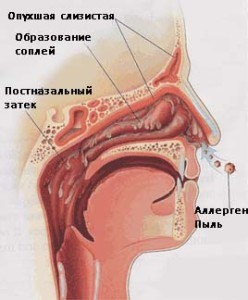 Как убрать сопли из носоглотки ребенка до года? Как убрать сопли из носоглотки ребенка до года?