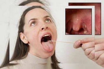 Как убрать сопли из носоглотки ребенка до года? Как убрать сопли из носоглотки ребенка до года?