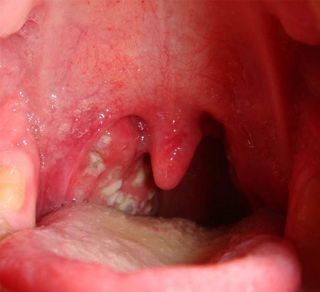 Как убрать сопли из носоглотки ребенка до года? Как убрать сопли из носоглотки ребенка до года?