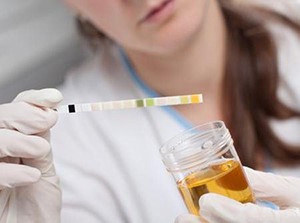 Что значит уробилиноген в моче Что значит уробилиноген в моче