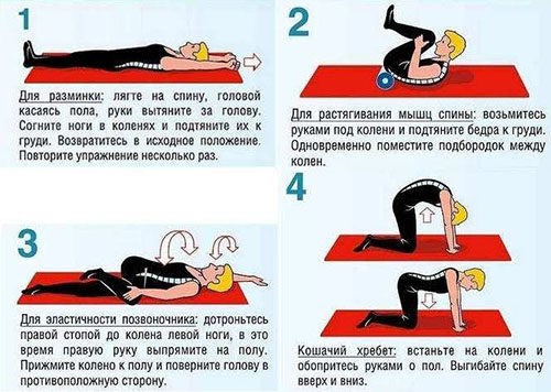 Защемление ягодичного нерва как лечить Защемление ягодичного нерва как лечить