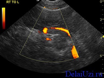 Подготовка к узи поджелудочной железы: нормы размеров у взрослых Подготовка к узи поджелудочной железы: нормы размеров у взрослых