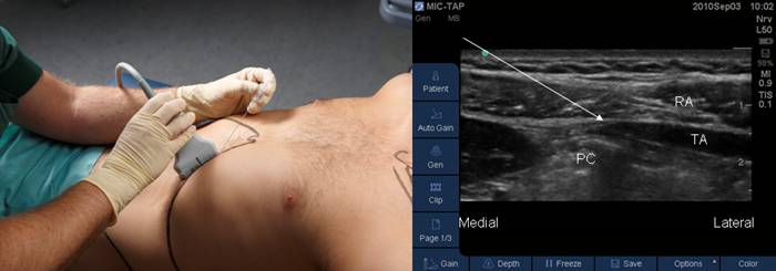 Поджелудочная железа размеры головка тело хвост Поджелудочная железа размеры головка тело хвост