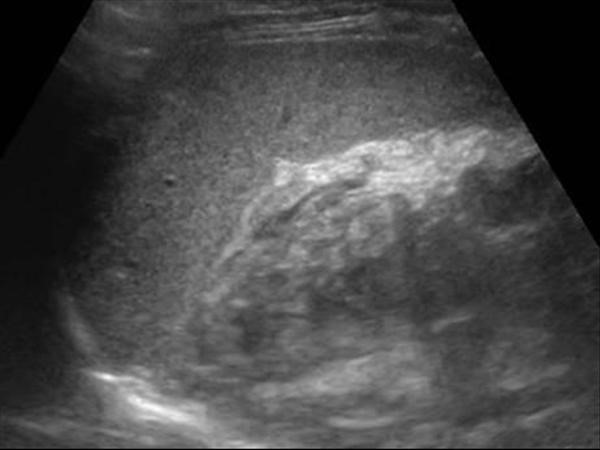 Поджелудочная железа размеры головка тело хвост Поджелудочная железа размеры головка тело хвост