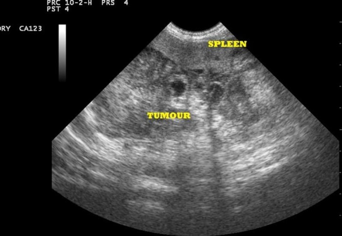 Поджелудочная железа размеры головка тело хвост Поджелудочная железа размеры головка тело хвост
