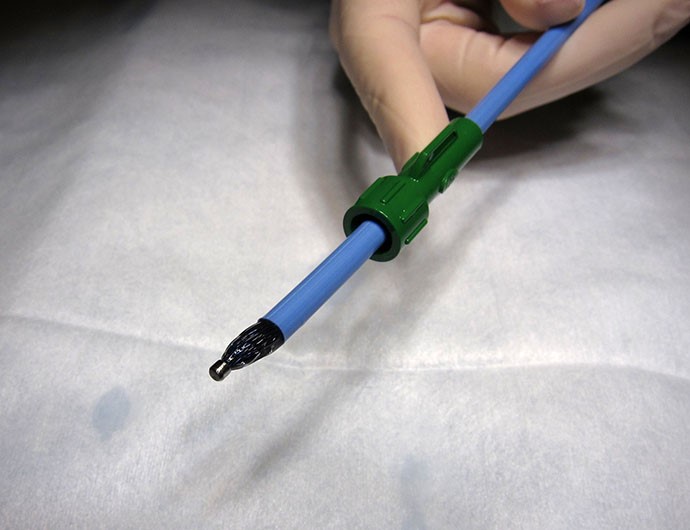 Аневризма межпредсердной перегородки (МПП) и ее лечение Аневризма межпредсердной перегородки (МПП) и ее лечение