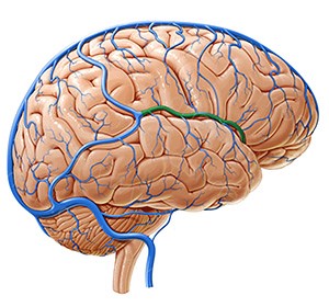 Венозная дисциркуляция головного мозга Венозная дисциркуляция головного мозга