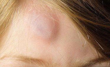 Особенности паренхиматозного кровотечения и его остановка Особенности паренхиматозного кровотечения и его остановка