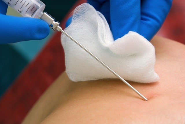 Воспаление лимфоузлов на шее Воспаление лимфоузлов на шее