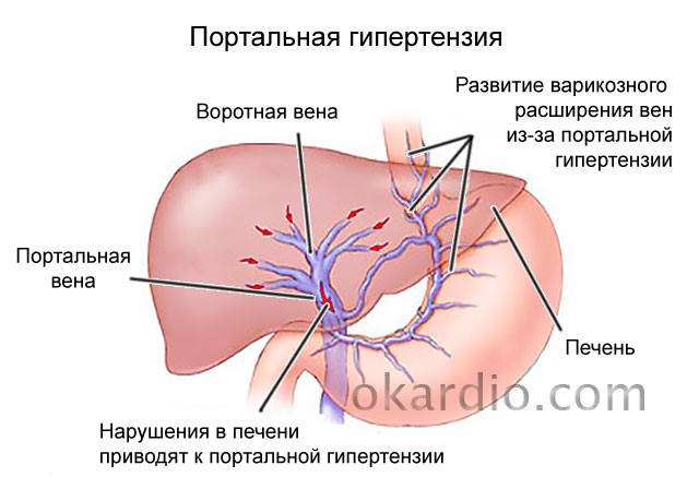 Симптомы и лечение кровотечения в желудке Симптомы и лечение кровотечения в желудке