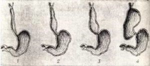Жжение в горле: причины, симптомы, лечение Жжение в горле: причины, симптомы, лечение