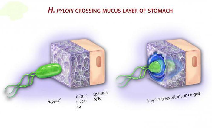эрадикационная терапия у детей