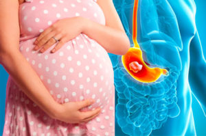 Беременная девушка и гастрит желудка в организме картинка