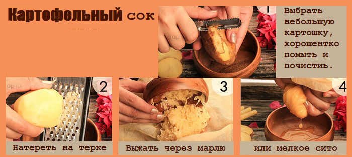 сок картофеля при гастрите