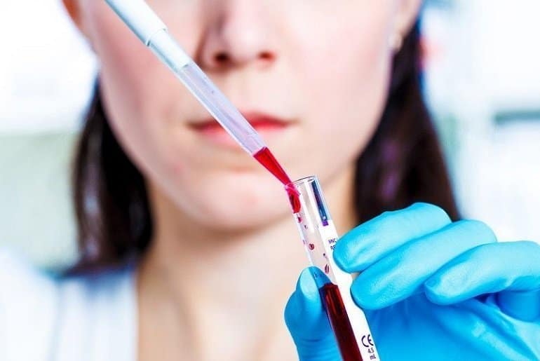 Анализ крови фото Анализ крови