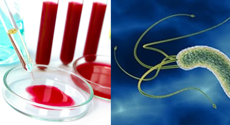 как понять что у меня гастрит