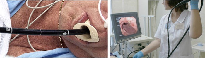 Мужчину врач проверяет эндоскопом картинка