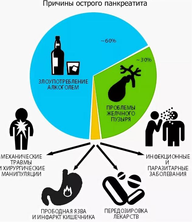 острый панкреатит причины