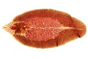 Печеночная фасциола