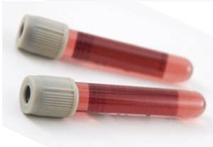 Печеночные пробы