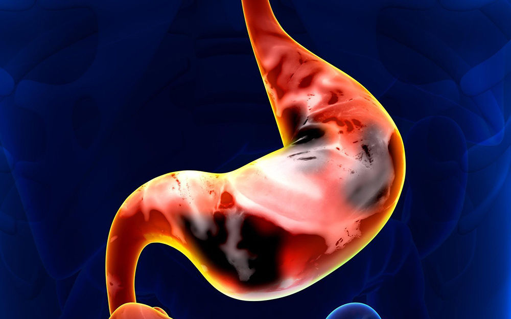 Перерождение в рак Перерождение в рак