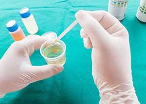 Почему билирубин показывается в моче