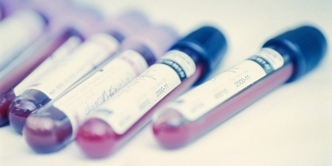 Анализ крови